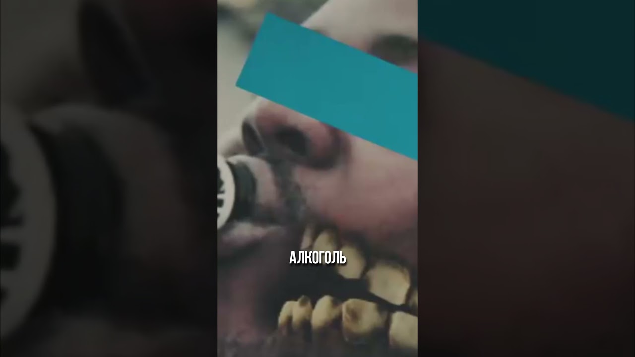 Кодеиновая эпидемия #shorts #кодеин #африка