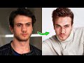 Турецкие актёры, которые сделали пластическую операцию: до и после 2022 📸