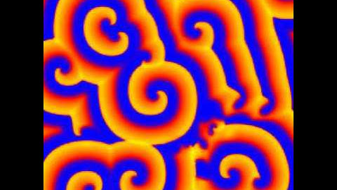 Spiral Wave Breakup - Mechanism 4