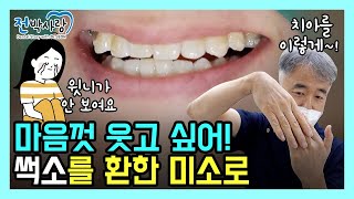 웃을 때 잇몸이 안 보여요...😭😭 잇몸 좀 찾아주세요✅