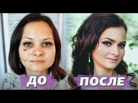 До и после • Как скрыть шрамы и синяки • Ужасная история