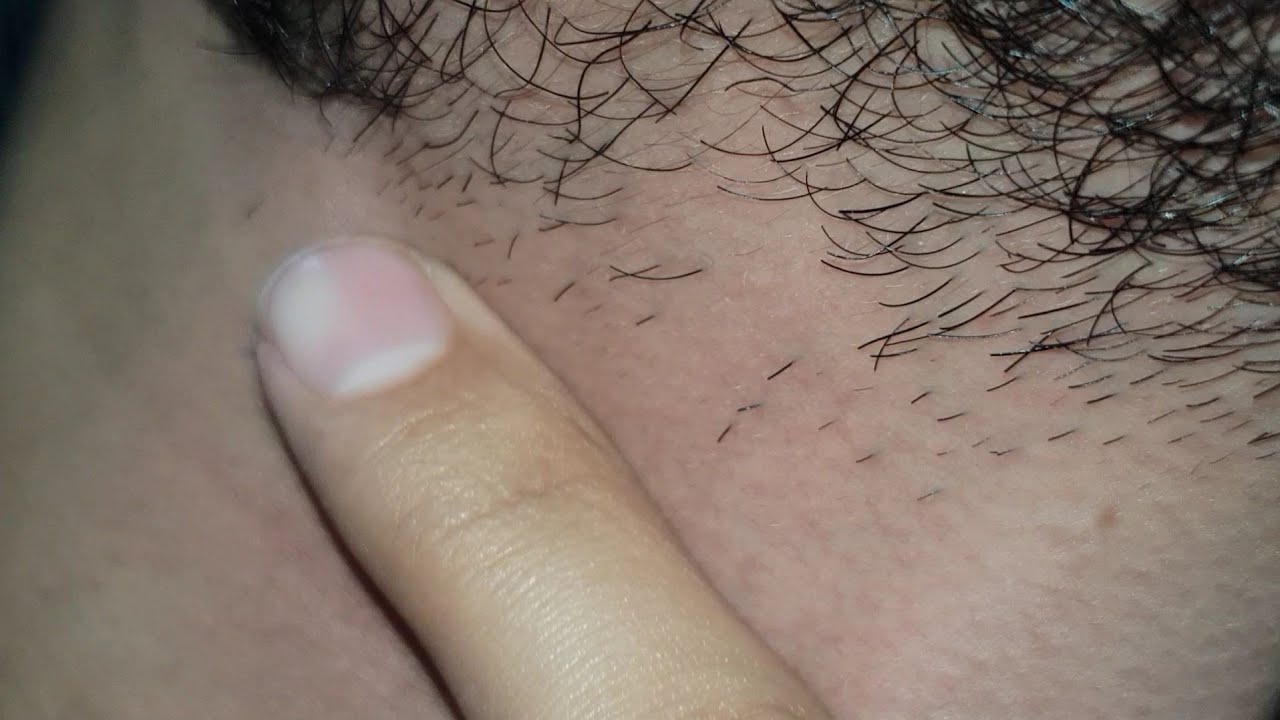 ASMR Relaxing Massage therapy Satisfying | Beard hair scratch sounds ...