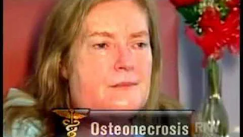 Attorney for necrosis jawbone death Fosamax & Boniva