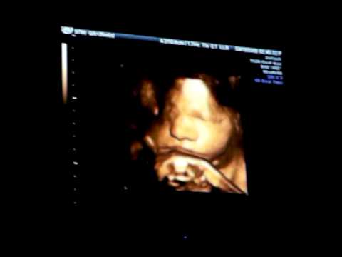 35 week ultrasound