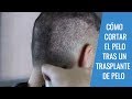 CORTE DE PELO TRAS UN TRASPLANTE DE PELO: Pautas para el corte de pelo