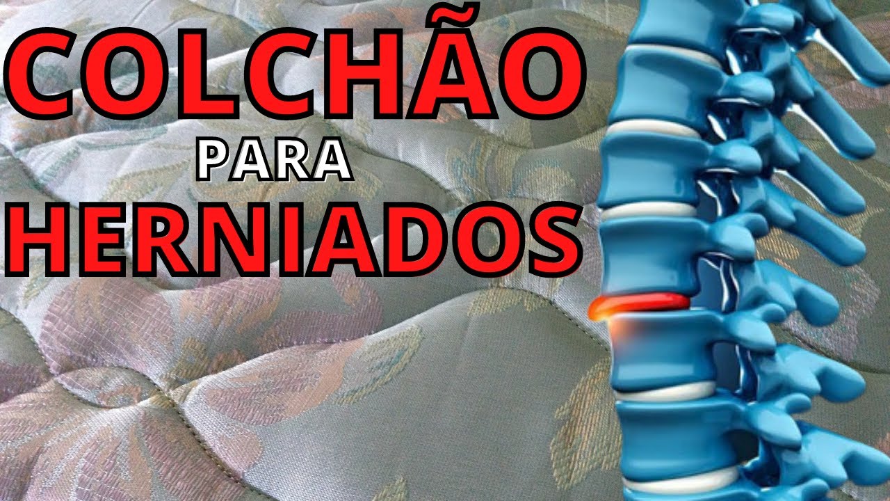 Como escolher um colchão para quem tem HÉRNIA DE DISCO? - YouTube