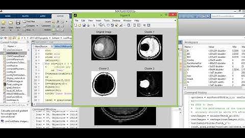 Brain Tumor Segmentation using Convolutional Neural Networks in MRI Images