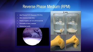 Presentation - Presutured Allograft GraftLink Augmented with StimuBlast Demineralized Bone Matrix
