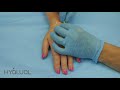 Редермализация рук