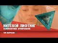 Нитевое армирование: установка рассасывающихся нитей