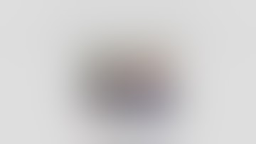 Kinematically Aligned CS GMK Sphere TKA by dr.Michele Malavolta