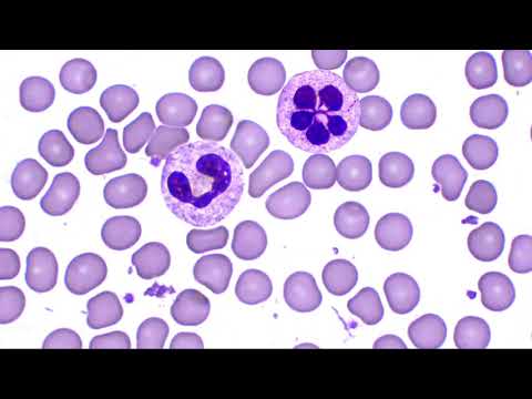 Video: Krvne Celice - Podzemne Celice, Brador, Pest Gratije, Kirurški Oltar