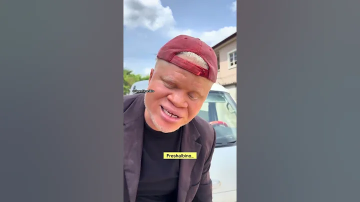 Na lie!!! Albino must pay #funny #prankvideo #comedy #funnyprank #comedyskits #prankideas #albino thumbnail