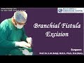 Branchial Fistula Excision - Dr. S.M Balaji