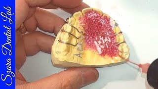 How retainers are made by Szara Dental