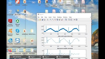Detecting the Heart Rate from an ECG (HRV) - Matlab projects!