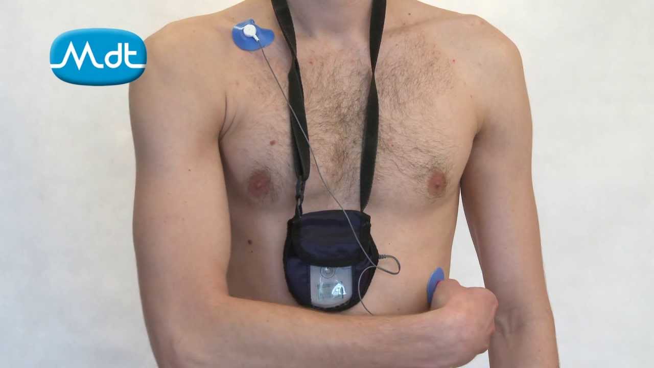 Epizodní záznamník s automatickou detekcí arytmií