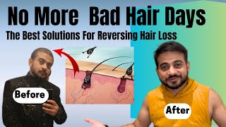 Hair Loss Kyu Hota Hai ? | Kya Treatment Se Hair Loss Ho Rha Hai | Solutions | ​⁠@Raj-Veer by Raj Veer 3,816 views 11 months ago 12 minutes, 6 seconds