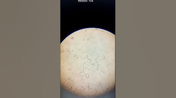 algae practical  (for bsc first year) #neet2023 #bsc #botany #practical  #universityofallahabad