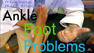 👣  تيبس القدم و تحسن (من اول جلسه) 👣😬 Ankle stiffness post fracture improved in 1st session