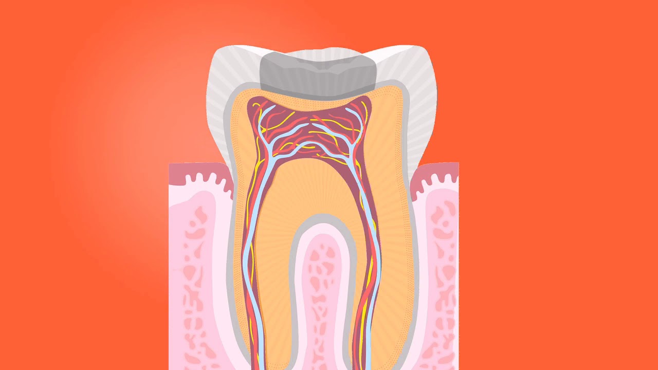 Root Canal Treatment Technology