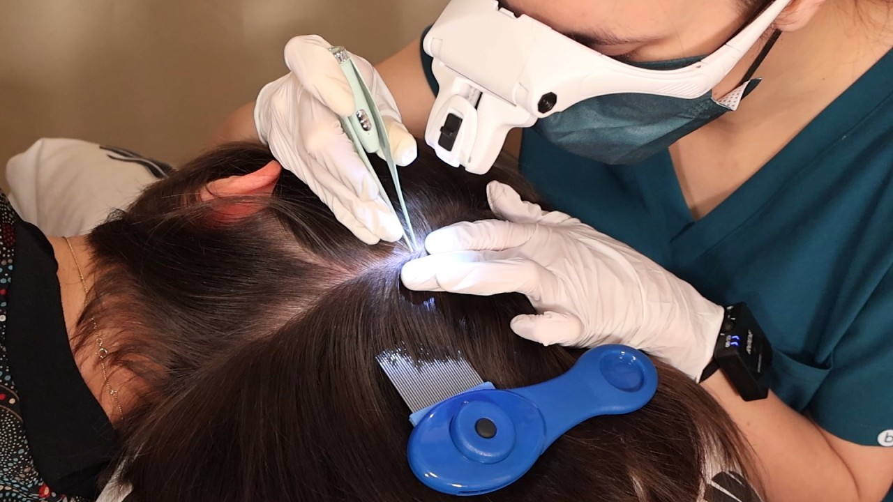 ASMR School Nurse LICE Check on SCALP | Lices Removal & Detailed Exam