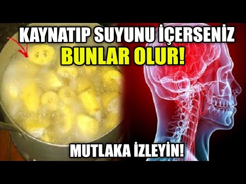 Yatmadan Önce Muz'u Kaynatıp Suyunu İçin! Bakın neye iyi geliyor!