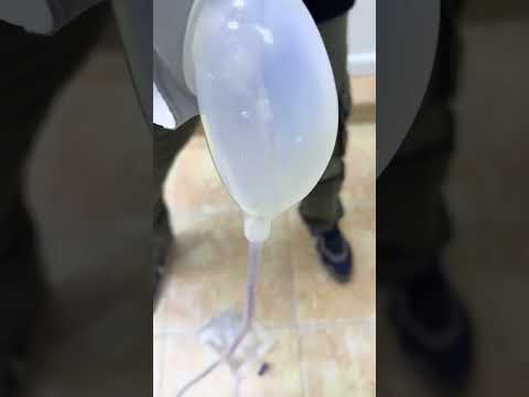 رجل كبير تتبول عل نفسك طريقة استعمال كيس التبول