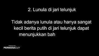 Waspada! Bagian Putih di Kuku Jari Ternyata Punya Arti Penting Untuk Kesehatanmu