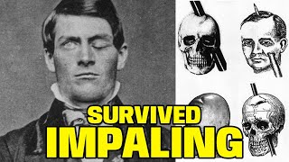 The Deadliest Accidents People Somehow Survived