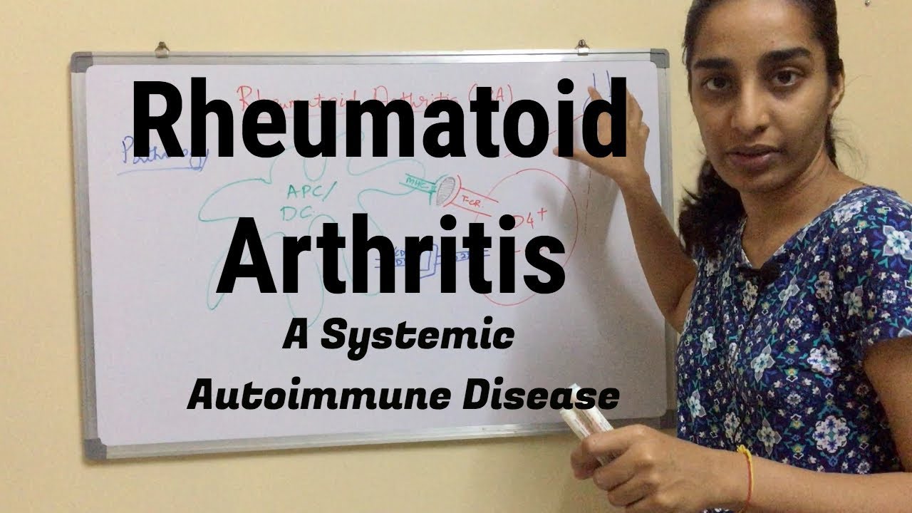 Rheumatoid Arthritis Immunology of Rheumatoid Arthritis Autoimmune