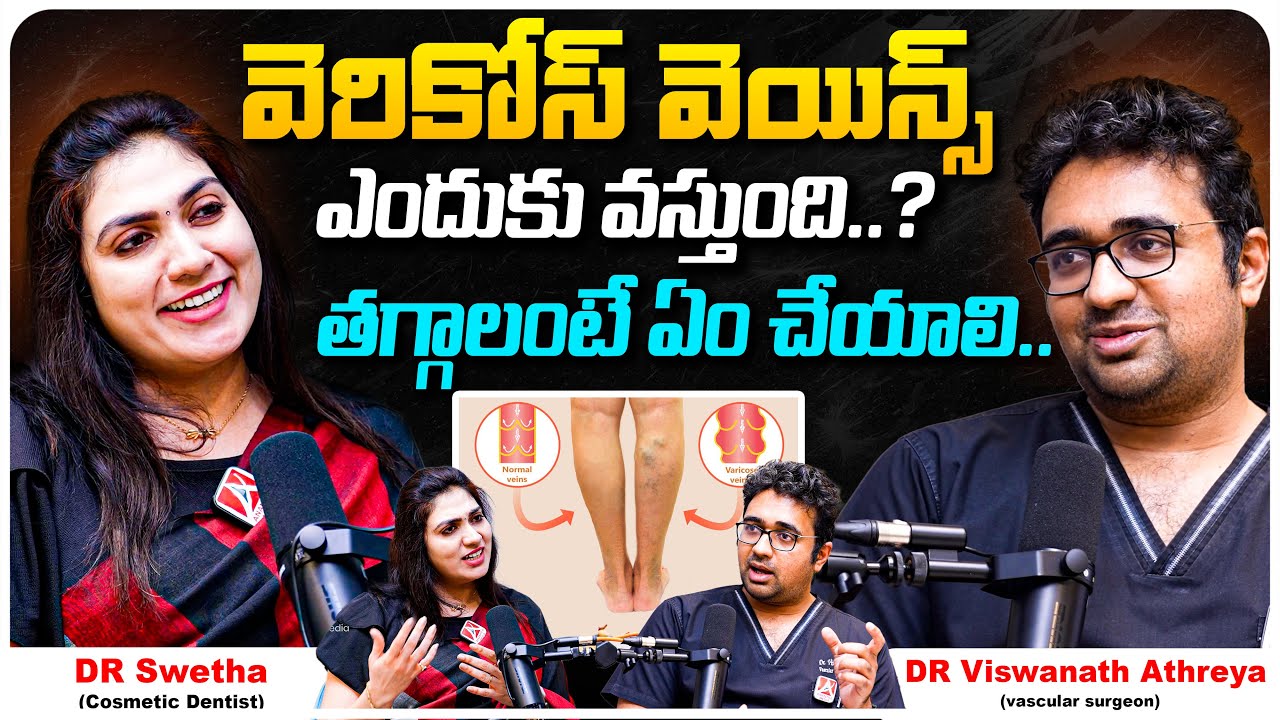 THE 9 BEST WAYS TO TREAT VARICOSE VEINS PROBLEMS | Dr Viswanath | Dr Swetha | Anantra Media