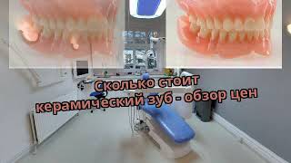 Сколько стоит керамический зуб - обзор цен Сколько стоит керамический зуб - обзор цен