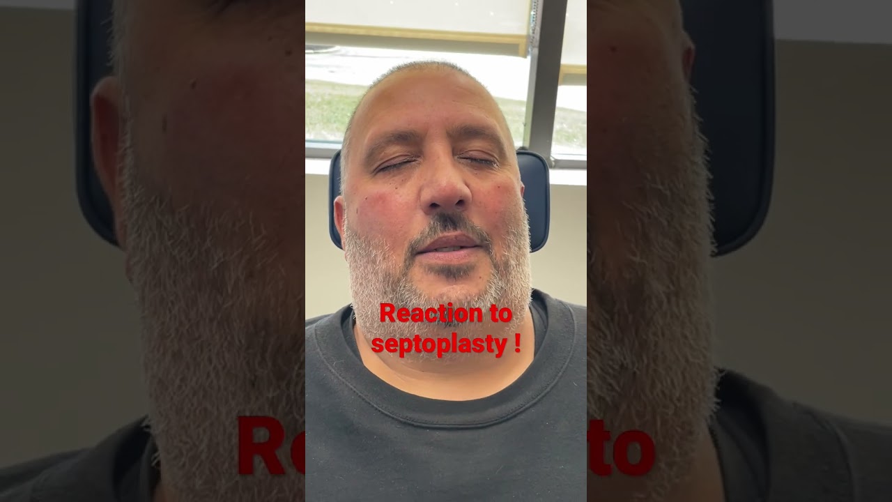 Первая реакция на септопластику после снятия шины