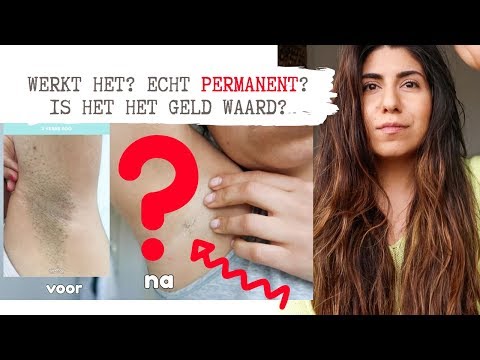 Video: Is Laserontharing Permanent?