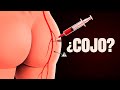 ¿Dónde pinchar una intramuscular para no lesionar el nervio ciático?