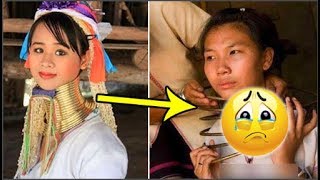 Tháo bỏ chục chiếc vòng ở tộc cổ dài nhất thế giới, nhìn những ‘mỹ nhân hươu’ khi đó thật chua xót