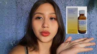 Download lagu EFFECTIVE NA GAMOT SA BULATE NG BATA | PAMPURGA