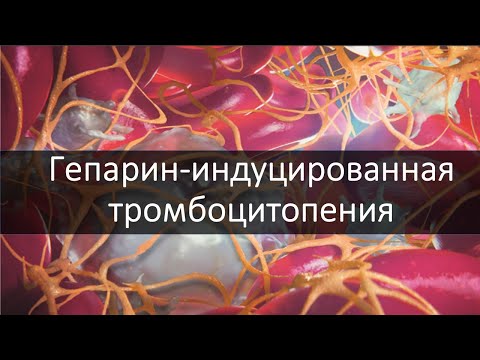 Гепарин-индуцированная тромбоцитопения