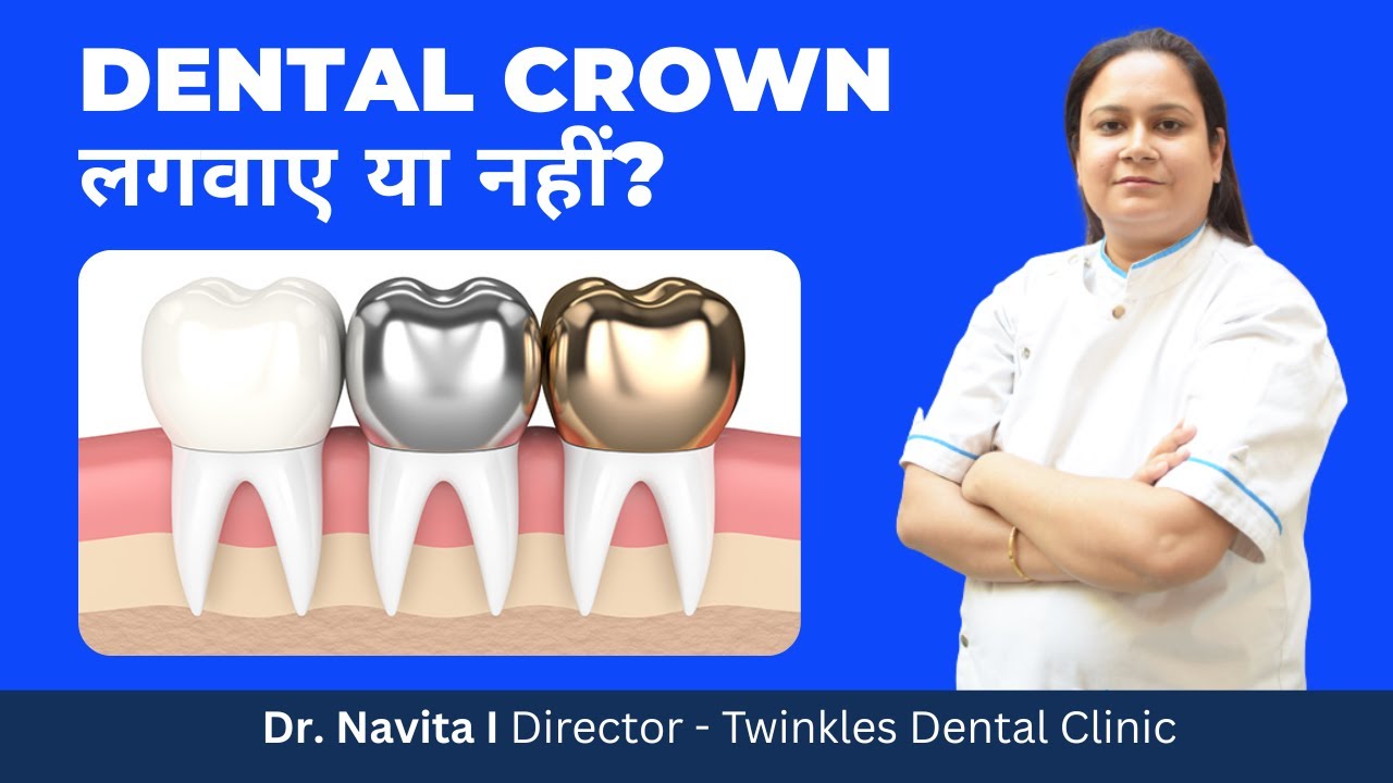 Dental Crown [Front Tooth] Steps Explained Dental Clinic