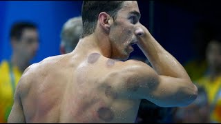 What Is Cupping In 60 Seconds