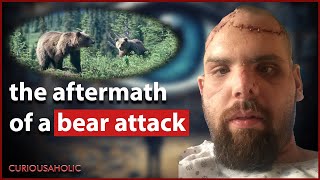Jeremy Evans Hiked 12Kms After Being Mauled