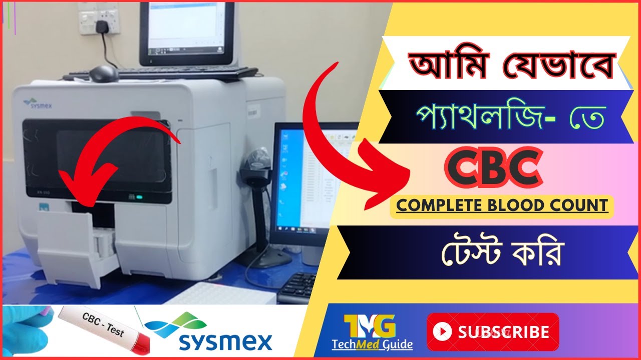 দেখুন কিভাবে CBC টেস্ট করে? CBC test kivabe kore CBC Test CBC Blood