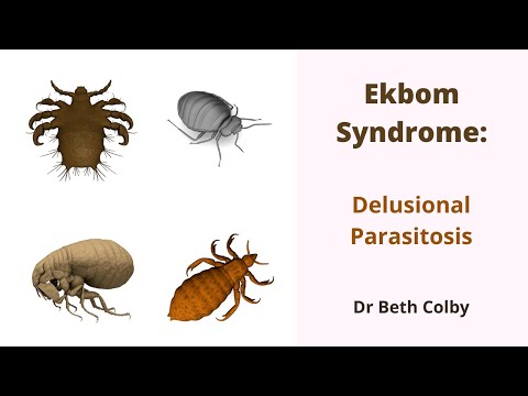 एकबॉम सिंड्रोम - भ्रामक पॅरासिटोसिस