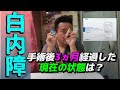 【白内障】手術後3か月過ぎてレンティスコンフォートはどんな感じ？