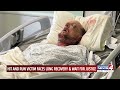 Hit-and-run victim faces long recovery & wait for justice