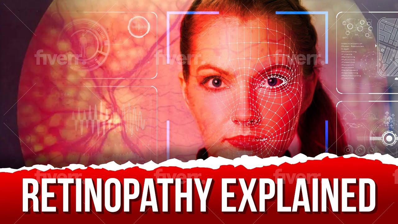 Diabetic Retinopathy Explained YouTube