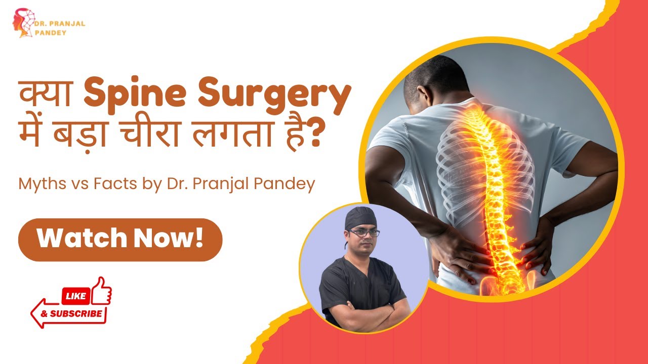 क्या Spine Surgery में बड़ा चीरा लगता है? | Myths vs Facts | Best Spine Surgeon in Delhi