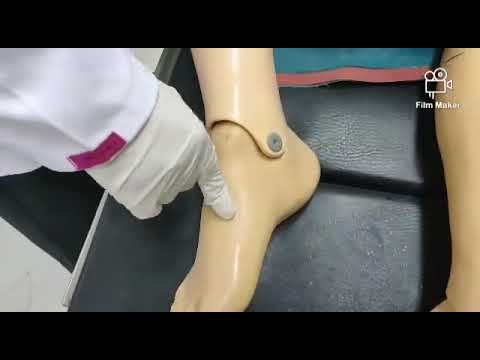 Pitting Edema Assessment Skill Video Mkv 