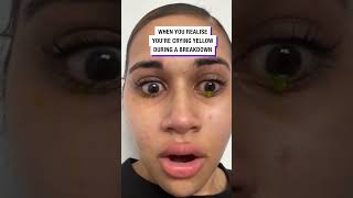 When You Cry Yellow Tears   Tt Urfavcolouredgirl